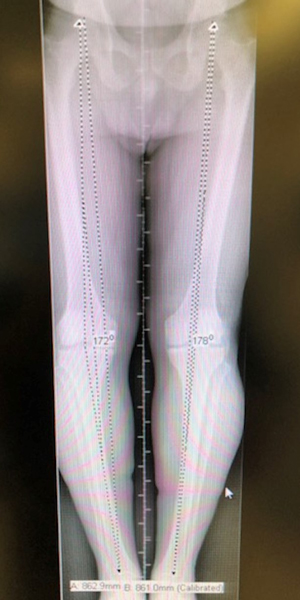 stading knee x-ray