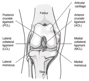ACL Tear