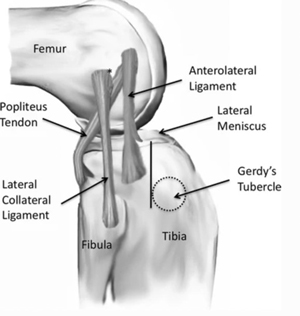 The Anterolateral Ligament: A “New” Knee Ligament