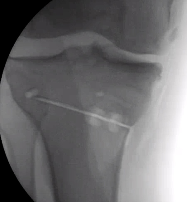 knee x-ray