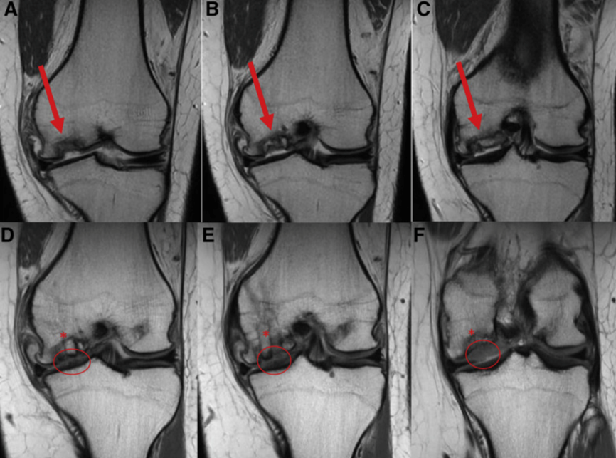 coronal anteroposterior MRI views