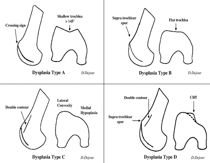 Imaging-dysplasia